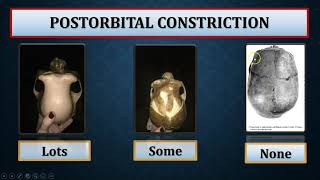 The Australopithecines and Early Members of Genus Homo (Part II)