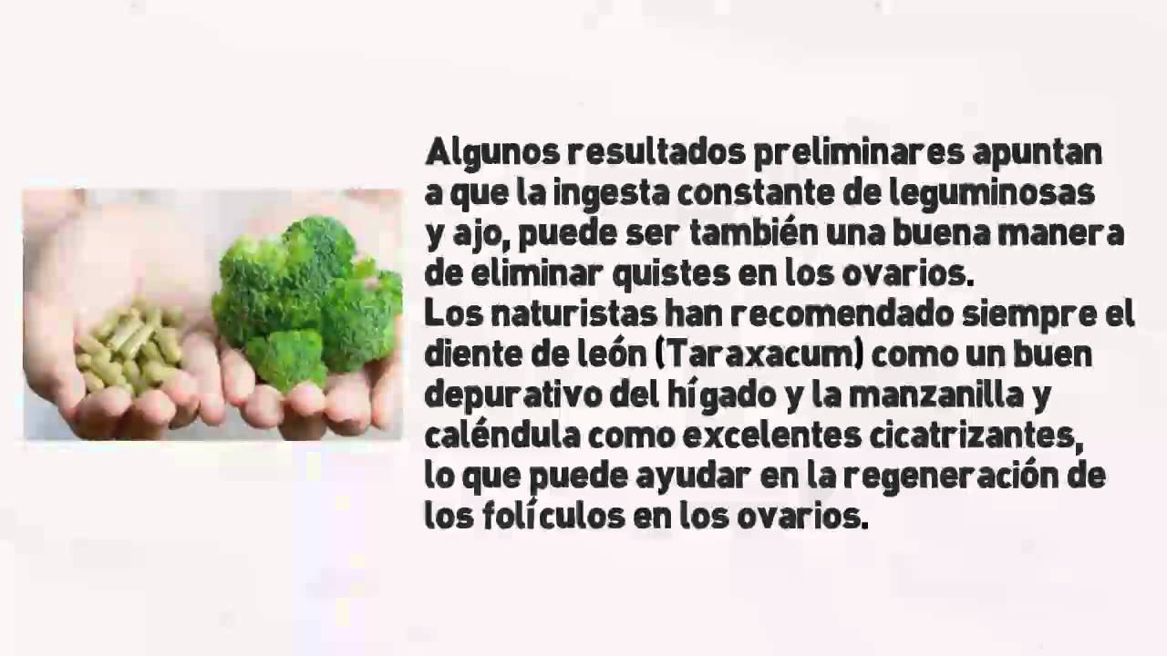 Pasos Sencillos para Eliminar los Quistes en los Ovarios [Tratamiento