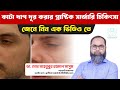শরীরের কাটা দাগ দূর করতে প্লাস্টিক সার্জারি | Dr. Md. Mahbubur Rahman - Plastic Surgeon in Dhaka