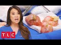 Patient's Scalp is Covered in Pilar Cysts! | Dr. Pimple Popper