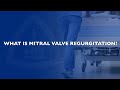 Frequently Asked Questions about the Mitral Valve