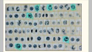 Mitotic index