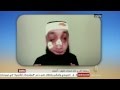 الشاب أشرف في مهمة مستحيلة إبداع الإحتجاج