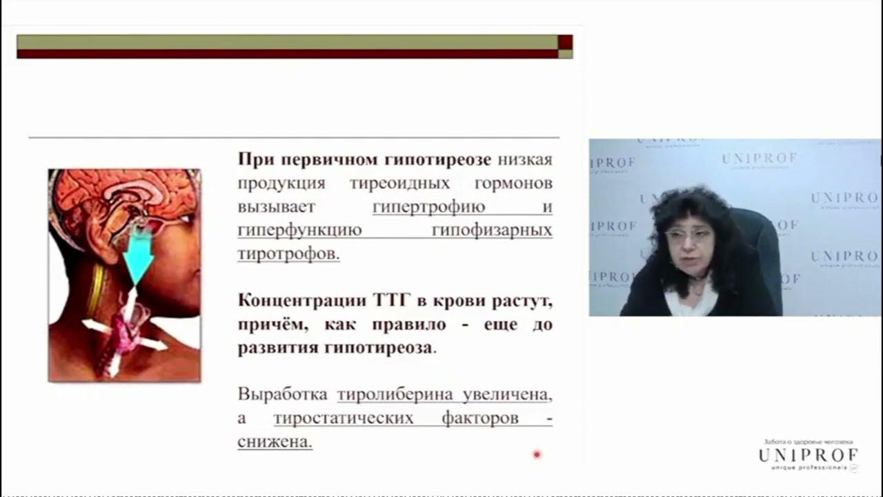 Жалобы при гипотиреозе. Первичный вторичный третичный гипотиреоз. Гиперпролактинемия эндокринология.