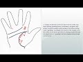 Palmistry &quot;Palm reading&quot; lines and signs of win lottery, casino | Inheritance, luck, fortune |