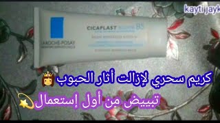 تجريبتي مع أروع كريم طبي يعالج أثار الحبوب cicaplast bumbe b5 حل لجميع أنواع البشرة