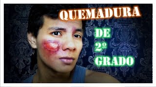 Quemadura de 2º Grado Make up Fx