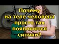 Почему на теле человека просто так появляются синяки?