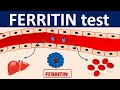 Serum Ferritin test || It's role in inflammation