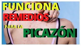 ¿Cómo quitar la comezon remedios caseros?