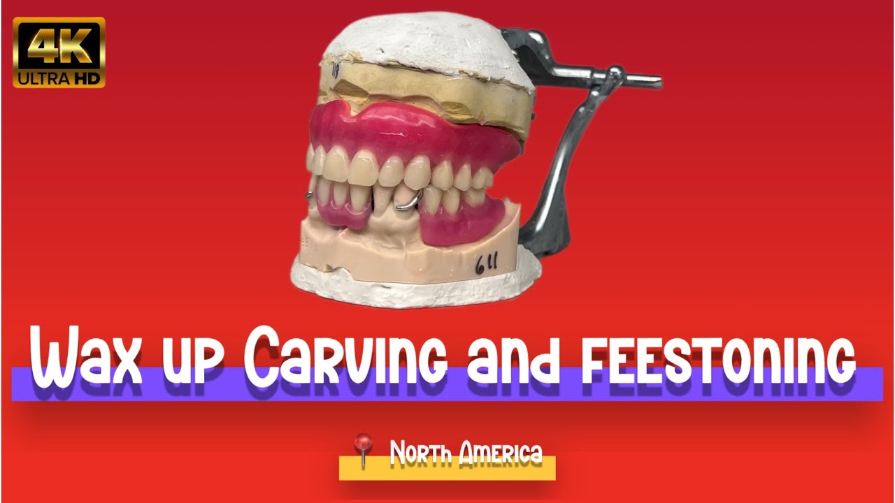 Wax-Up & Carving — My Favorite Part of Dental Lab Work