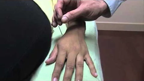 How To Manipulate an Acupuncture Needle | Oriental...