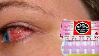 Information on Cendo Genta 0.3% Eye Drops to treat bacterial eye infections