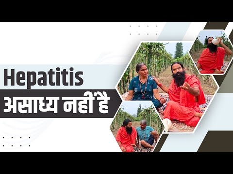 Hepatitis असाध्य नहीं है ll Swami Ramdev 