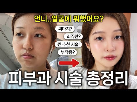 <strong>피부과</strong> 시술 &amp;amp; 얼굴 관리 총정리🔥 돈 절대 안 아까운! <strong>추천</strong> vs 비추천? 홈케어 꿀템? 망한 부작용썰...💉