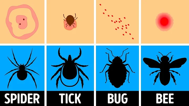 How to Identify a Bug Bite and What to Do With It - DayDayNews