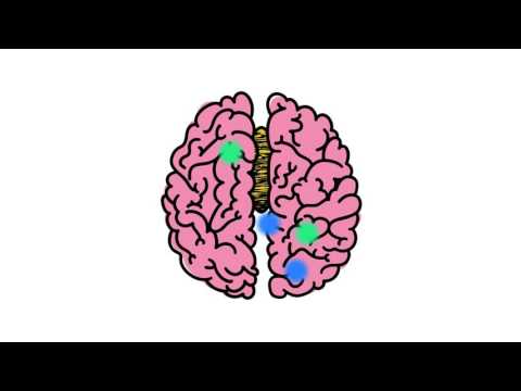 Understanding Disorders of the Corpus Callosum Animated Video (by NODCC)
