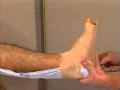 Posterior extended below knee slap