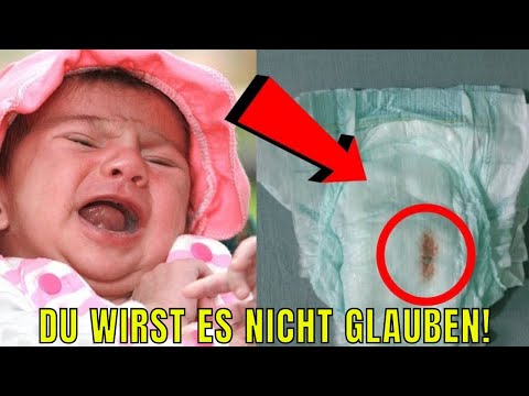 Video: So Entfernen Sie Schilde Von Bots