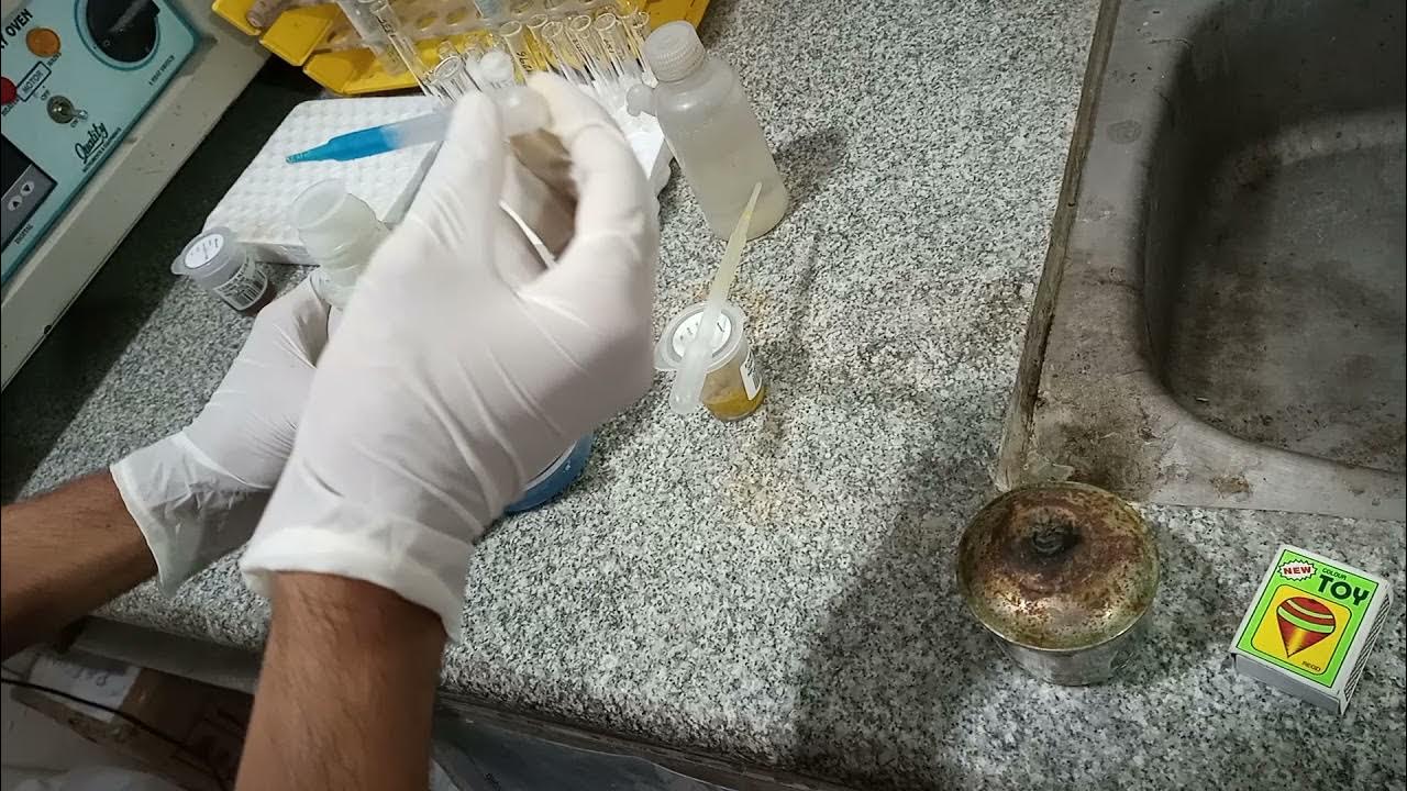 Stool Reducing Substance Test YouTube