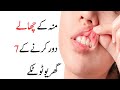 7 home remedies to get rid of mouth ulcers Revolution is Coming