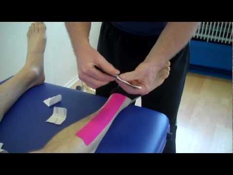 How to apply Kinesiology Taping for Tibialis Anterior Tendonopathy