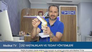 Di̇z Hastaliklari Ve Tedavi̇ Yöntemleri̇ Resimi