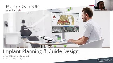 3Shape Design Service - Guided Surgery Design in Implant Studio