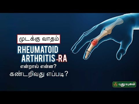 முடக்கு வாதம் என்றால் என்ன? கண்டறிவது எப்படி? Rheumatoid Arthritis | Doctor On Call | 13/09/2019