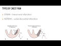 Chest Pain Rapid Review