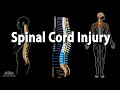 Spinal Cord Injury, Animation