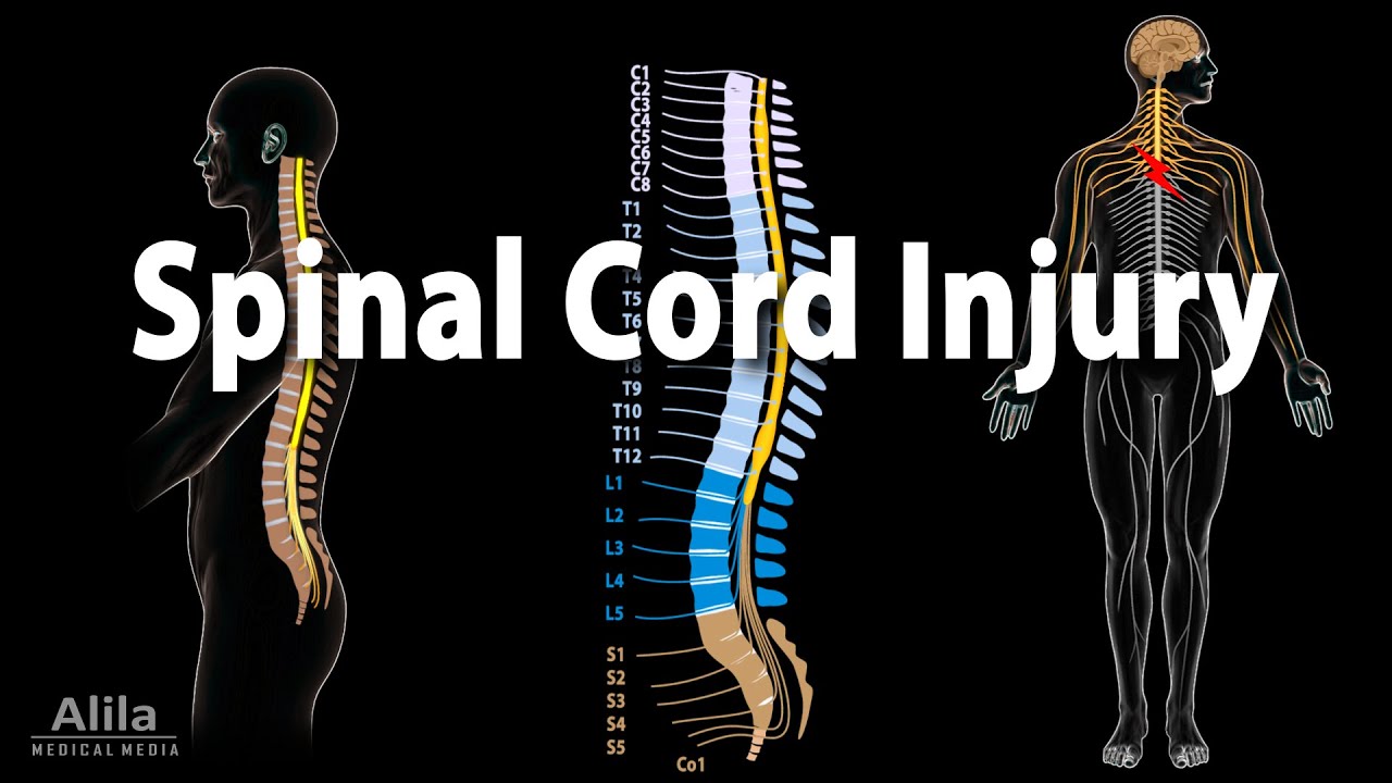 Thoracic Spinal Cord Injury: Functions Affected & Recovery