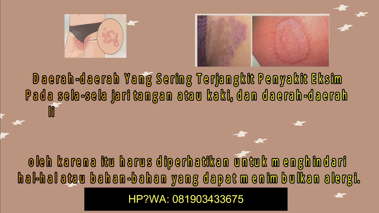 Cara Mengobati Gatal Kudis Dengan Kunyit
