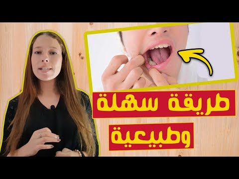 علاج التهاب اللثة بعد خلع الضرس !