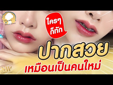 รีวิวปากกระจับ แบบ LISA BLACKPINK สวย ปัง ไม่ต้องพักฟื้น I รีวิวลูกสาวหมอ sowon clinic EP.106