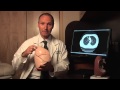 Lung Cancer Surgery