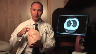 Lung Cancer Surgery