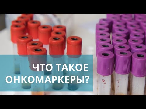 🧪 Онкомаркеры: что это такое, и когда нужно сдавать анализ на онкомаркеры? Онкомаркеры что это. 18+