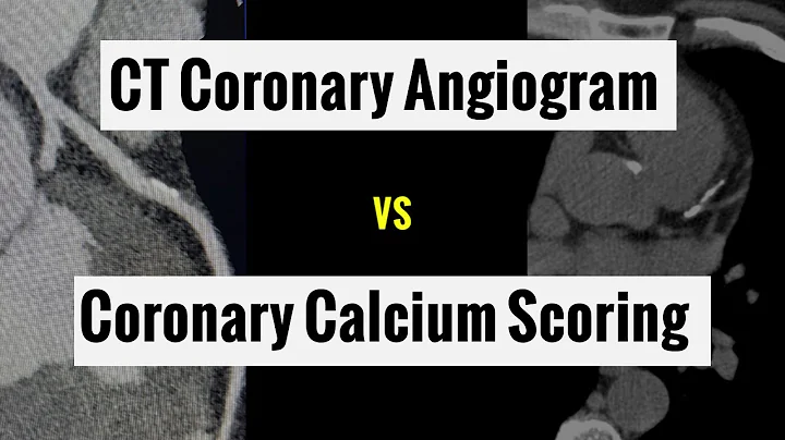 What is the difference between Coronary Calcium Scoring and CT Coronary Angiogram (2023)