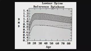 Genetic Disorders of Bone and Mineral Metabolism - Michael Whyte, MD screenshot 5