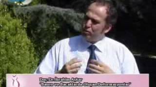 Dr.i̇brahim Aşkar Bacak Estetik Operasyonları Hakkında Bilgi Veriyor.