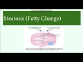 Fatty change( Steatosis): Etiology, Pathogenesis and Morphology