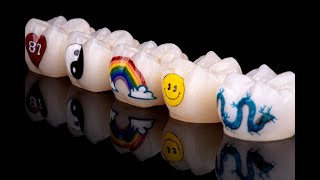 ADS Talks: Tat Tooth