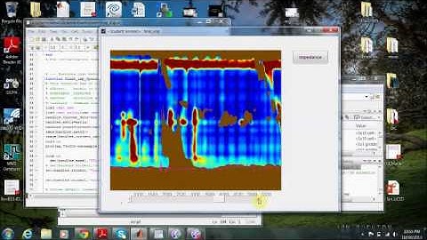 Intraluminal Impedance Visualizer