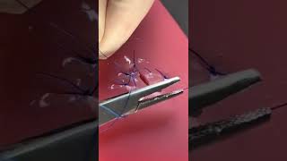 Dufourmentel Flap part 4