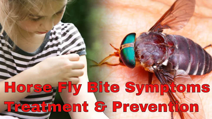 Horsefly Bites Symptoms & Treatment | Horse Fly Bite Cure & Prevention Advice - DayDayNews