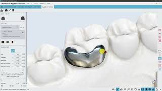 Maestro 3D | Dental Studio | Appliance Creator