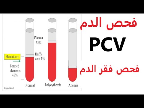 ما هو تحليل Pcv موسوعة Flashmode Arabia مقالات تعليمية مجانية معلومات ثقافية عامة موسوعة شاملة