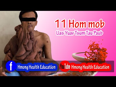 Video: Vim li cas ATP yog ib qho tseem ceeb molecule hauv metabolism?