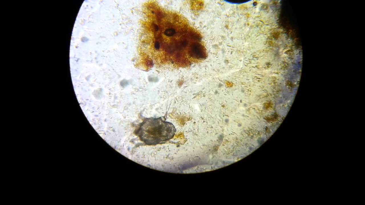 Ear Mite (Otodectes cynotis) from a cat